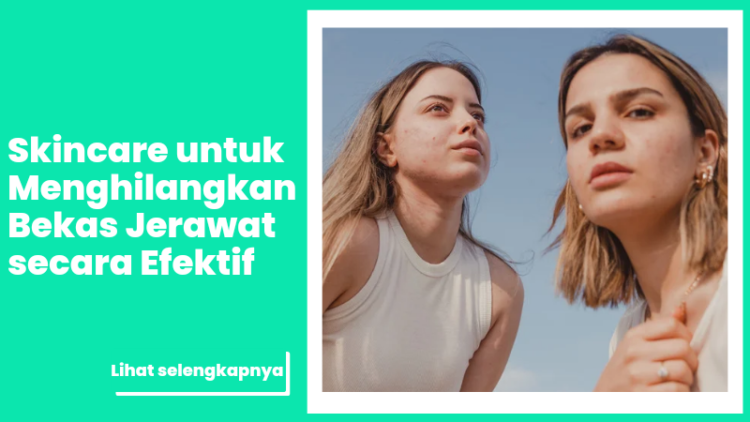 Skincare untuk Menghilangkan Bekas Jerawat secara Efektif