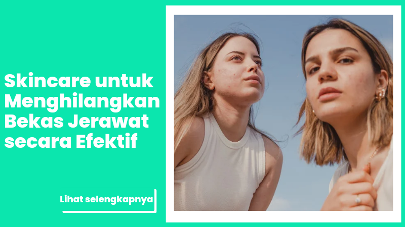 Skincare Efektif untuk Menghilangkan Bekas Jerawat